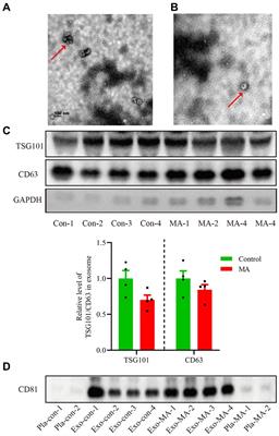 Circulating plasma and exosome levels of the miR-320 family as a non-invasive biomarker for methamphetamine use disorder
